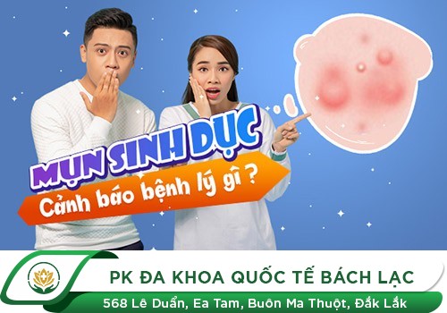 Không Nên Chủ Quan Với Bệnh Mụn Sinh Dục