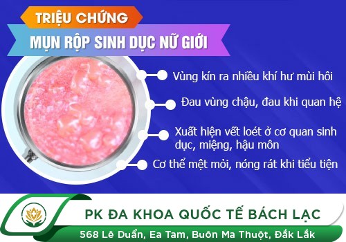Những Điều Nữ Giới Nên Biết Về Mụn Rộp Sinh Dục Nữ