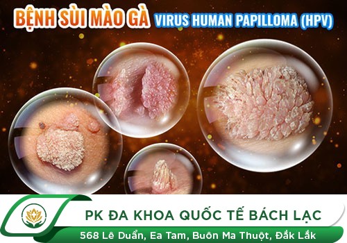 Mụn Cơm Sinh Dục Nguy Hiểm Như Thế Nào