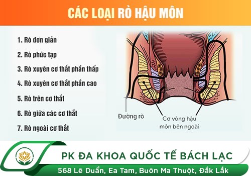 Đau Rát Hậu Môn Là Bệnh Gì?
