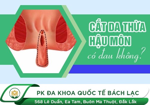Phẫu Thuật Trĩ Có Đau Không