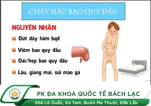 Bao Quy Đầu Chảy Máu Có Sao Không