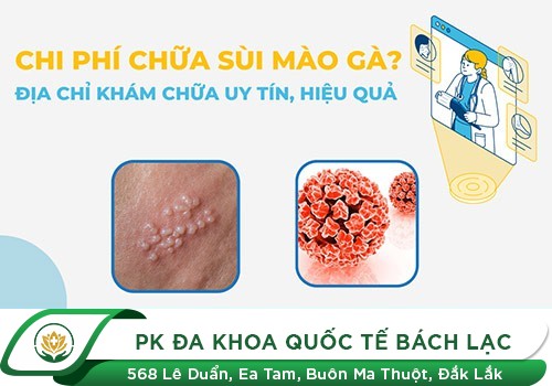 Chi Phí Chữa Bệnh Sùi Mào Gà Có Tốn Kém Không?