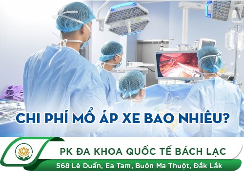 Chi phí mổ áp xe hậu môn là bao nhiêu?