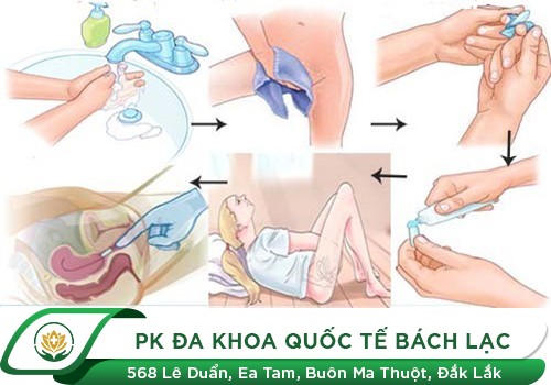 Thuốc trị viêm lộ tuyến cổ tử cung