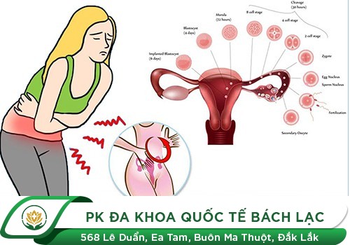 Đau Bụng Dưới Rốn Ở Nữ Là Mắc Phải Bệnh Gì?