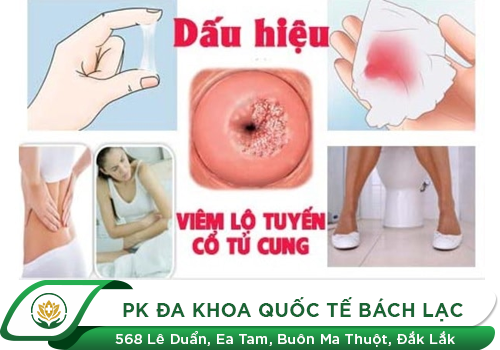 Viêm Lộ Tuyến Điều Trị Như Thế Nào Tốt Nhất