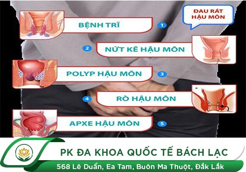 Đau Hậu Môn, Sưng Hậu Môn Là Dấu Hiệu Bệnh Gì?