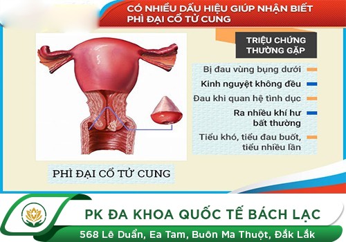 Phì Đại Cổ Tử Cung Là Bệnh Gì?