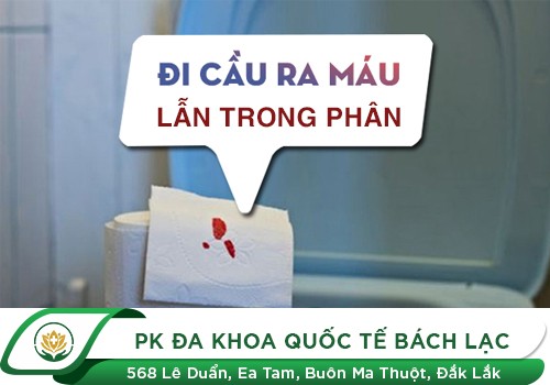 Sự nguy hiểm khi đi cầu có máu lẫn trong phân