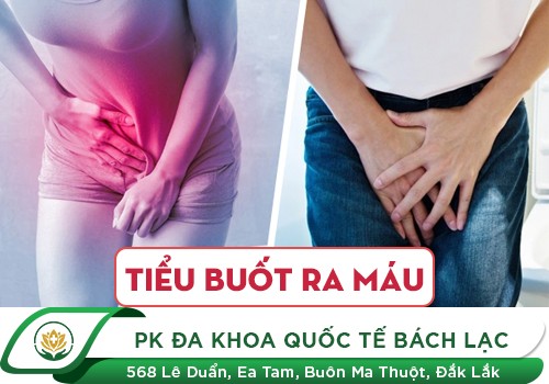 Tiểu buốt ra máu sau khi quan hệ là dấu hiệu mắc các bệnh nguy hiểm