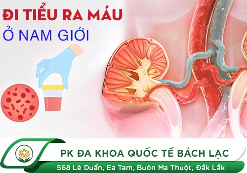 Đi đái ra máu là bệnh gì?