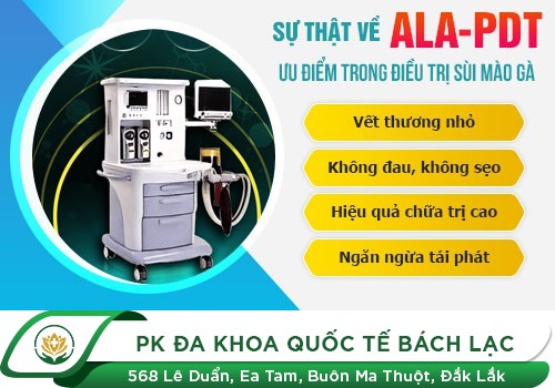 Địa Chỉ Hỗ Trợ Chữa Sùi Mào Gà Tại Đắk Lắk