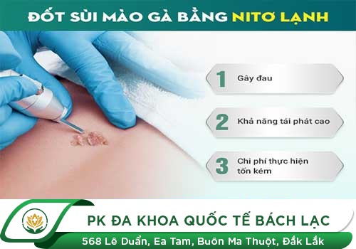 Đốt Sùi Mào Gà Có Trị Dứt Điểm Được Không