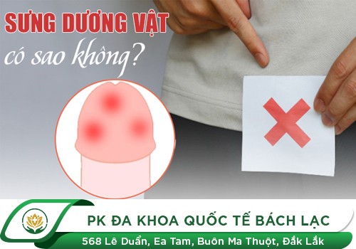 Cảnh báo dấu hiệu dương vật bị sưng ở đầu
