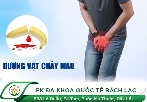 Tìm hiểu nguyên nhân dương vật chảy máu và cách điều trị hiệu quả
