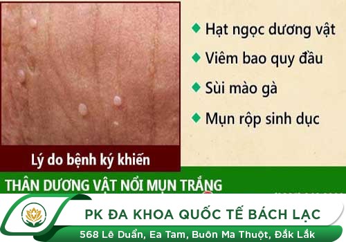 Nổi Mụn Trắng Ở Tinh Hoàn Là Bị Gì