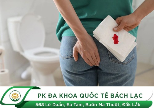 Hậu môn chảy máu - Dấu hiệu không nên xem thường