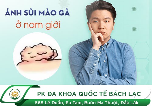 Nhận Biết Triệu Chứng Sùi Mào Gà Chính Xác Và Cách Chữa Hiệu Quả