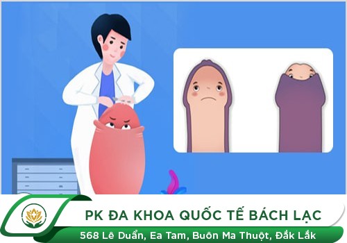 20 Tuổi Chưa Cắt Bao Quy Đầu Có Sao Không?