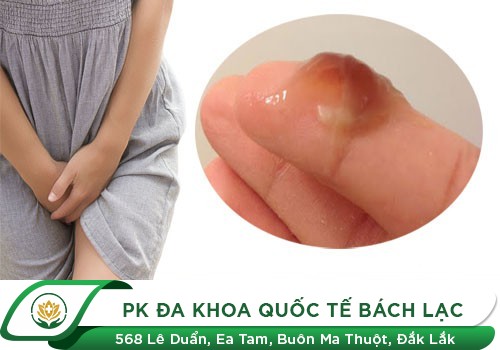Phân biệt máu báo thai và kinh nguyệt đơn giản, chuẩn xác nhất