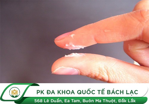 Cách chữa dứt điểm bệnh huyết trắng