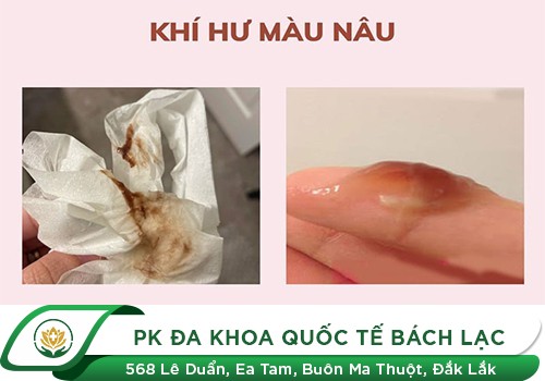 Cảnh Giác Với Triệu Chứng Khí Hư Màu Nâu