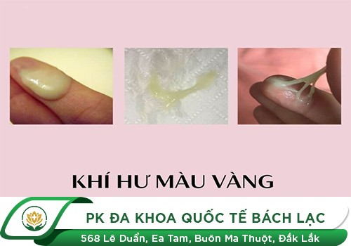 Ra khí hư màu vàng có nguy hiểm không