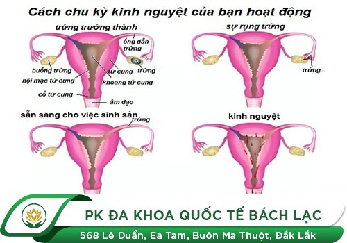 Nguyên nhân gây nên tình trạng vô kinh thứ phát