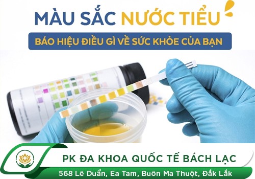 Màu nước tiểu bất thường báo hiệu điều gì?
