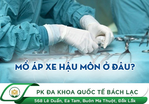 Mổ áp xe hậu môn ở đâu?