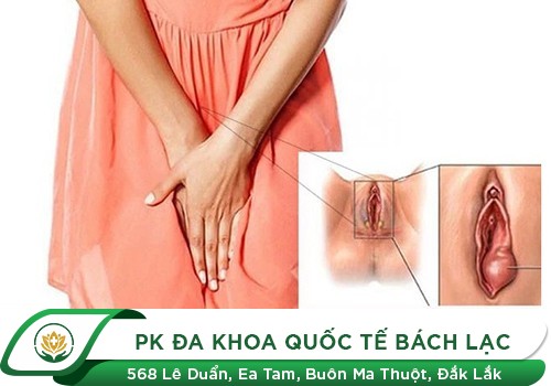 Cách Điều Trị Tình Trạng Sưng Môi Bé, Sưng Môi Lớn Gây Đau Ngứa Ở Nữ Giới