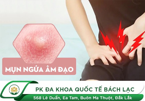 Nổi mụn viêm ngứa âm đạo điều trị như thế nào?