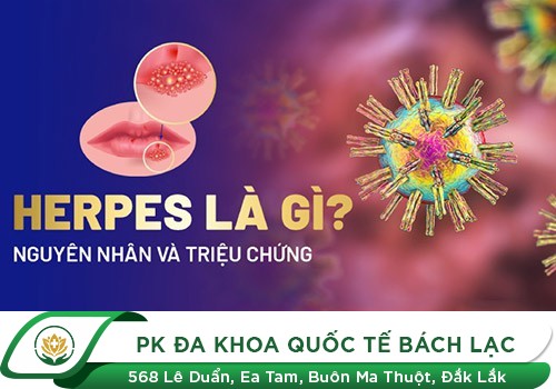 Âm Đạo Mọc Mụn Nước - Dấu Hiệu Điển Hình Của Mụn Rộp Sinh Dục Nữ