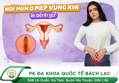 Bị Nổi Mụn Vùng Kín Phải Làm Sao Đây?