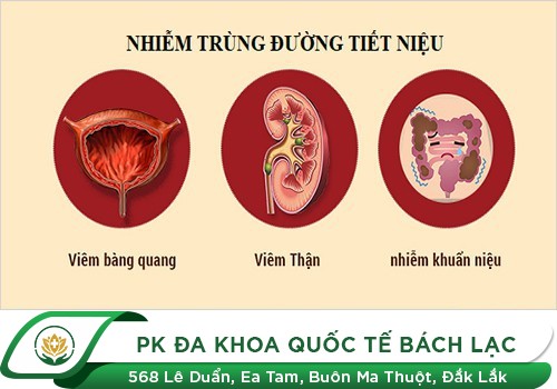 6 Dấu Hiệu Nhận Biết Sớm Nhiễm Trùng Đường Tiểu Ở Nam Giới
