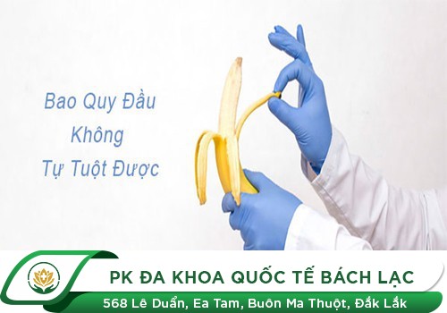 Vì đâu bao quy đầu không tự tuột được?