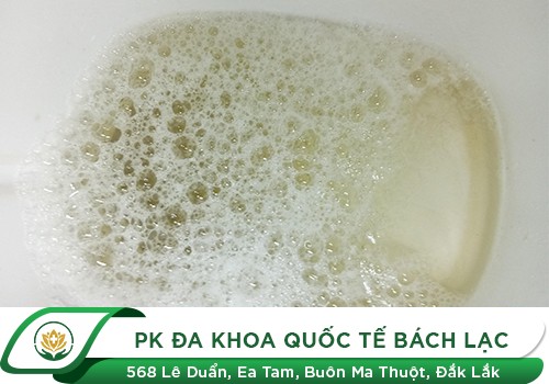 Nguyên nhân khiến nước tiểu có bọt