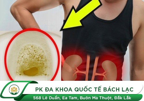 Nước tiểu đục