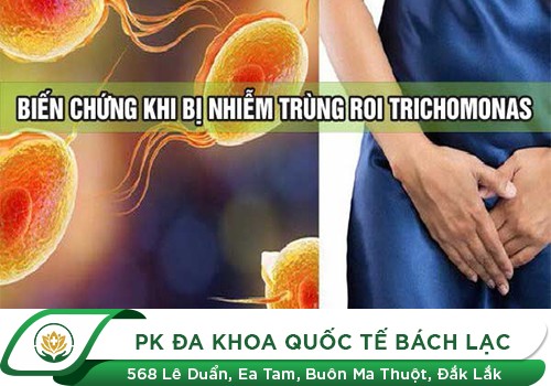 Nguyên nhân gây bệnh Trichomonas