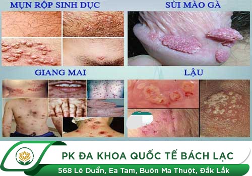 bệnh phụ khoa nam nguy hiểm