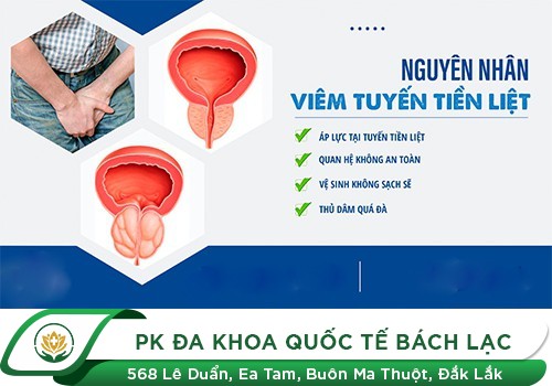 Nguyên nhân gây bệnh viêm tuyến tiền liệt ở nam giới