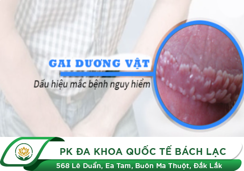 Dấu hiệu nhận biết gai dương vật ở nam giới