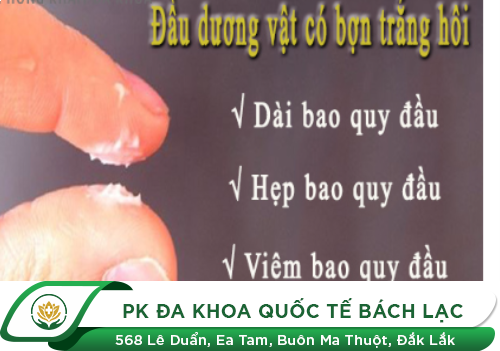 Nguyên nhân xuất hiện bợn trắng quy đầu