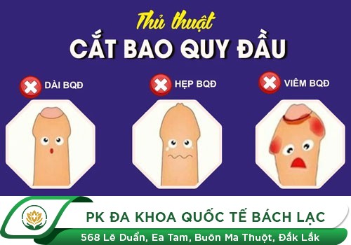 Các bệnh về vùng kín thường gặp ở nam giới