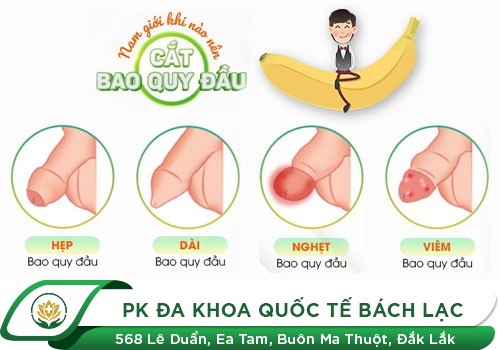 Khi nào cần cắt bao quy đầu?