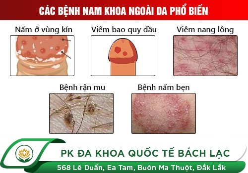Những bệnh nguy hiểm ở cậu nhỏ mà các chàng nhất định phải biết