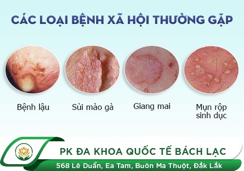 Bệnh Sinh Dục Nam Và Địa Chỉ Hỗ Trợ Điều Trị Chất Lượng Tại Đắk Lắk