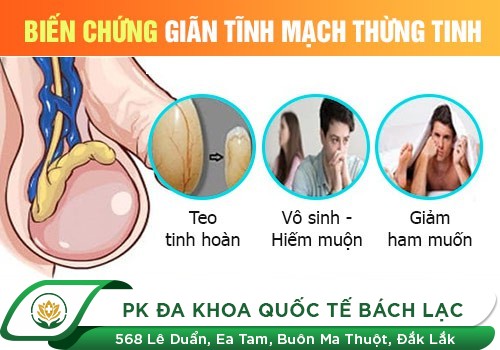 Nguyên nhân gây vô sinh nam
