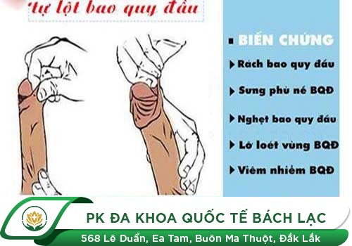 Tại sao nam giới trưởng thành không lột bao quy đầu?